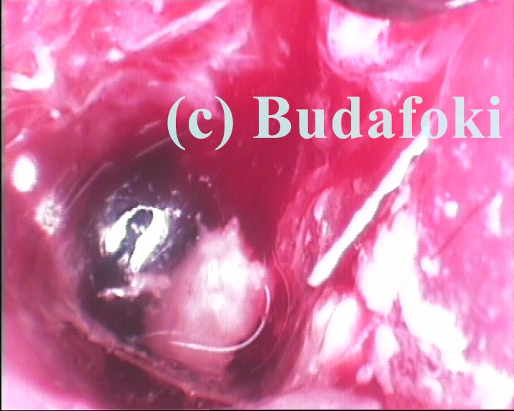 Kutya perforált dobhártyája video-endoszkópiás vizsgálaton